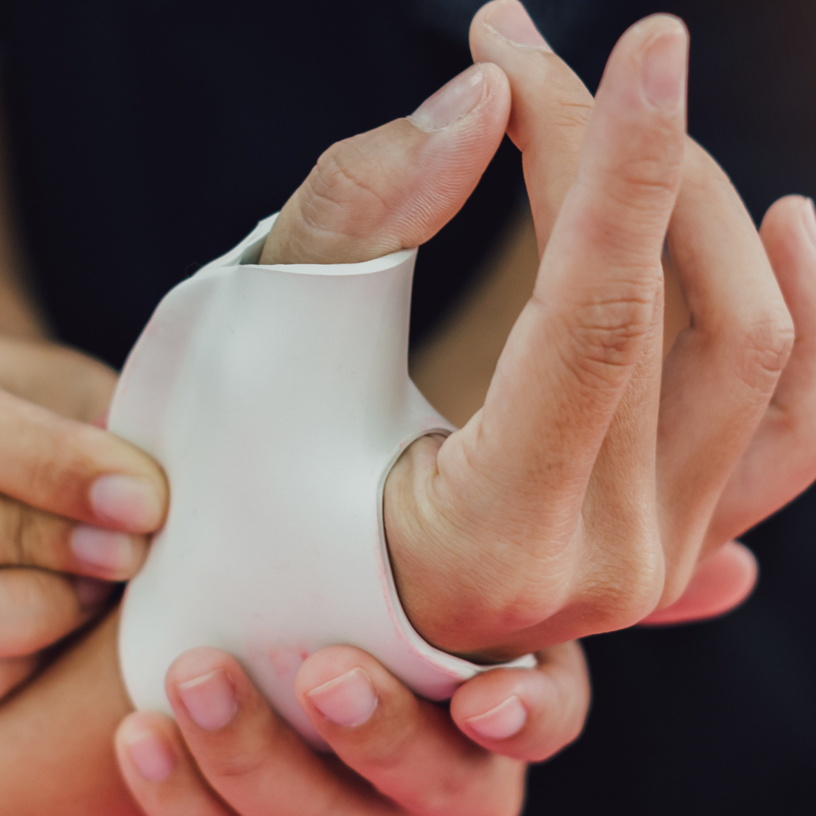 hand injuries